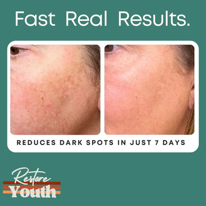 Dark Spot Serum Restore Youth